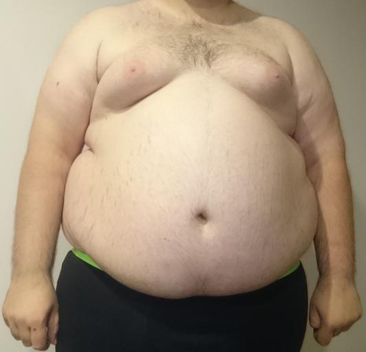 obézní muž